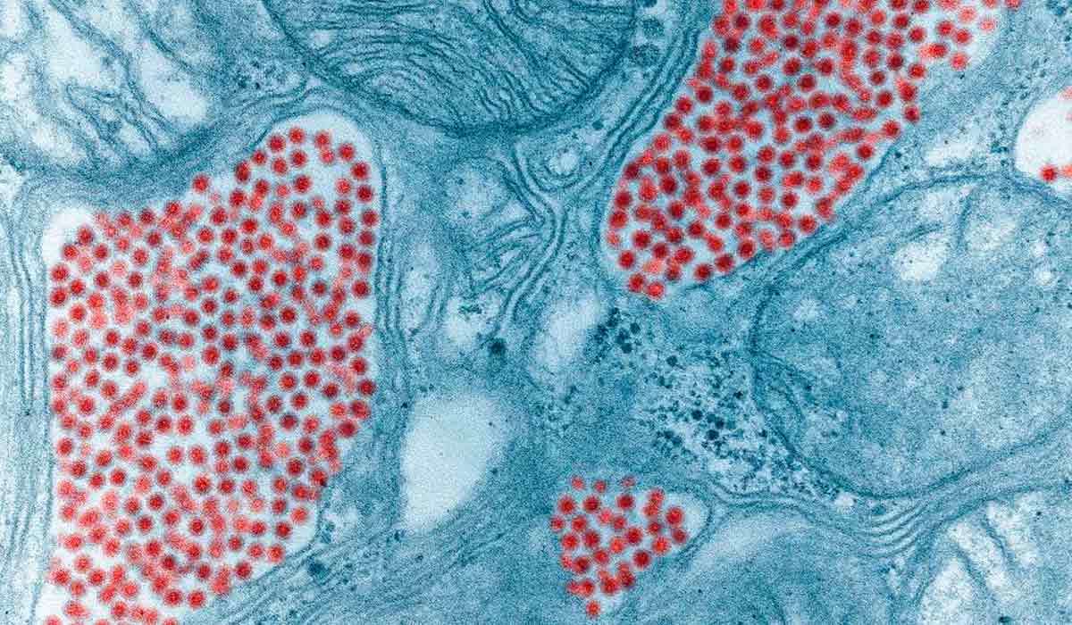 Micrografia eletrônica da glândula salivar de um mosquito que contém vírus da encefalite equina oriental. O mosquito é infetado com o vírus quando se alimenta do sangue de um animal virémico. O vírus amadurece e dissemina-se nos órgãos e eventualmente acumula-se nas glândulas salivares do mosquito - Foto: "Colourised TEM micrograph" por Fred Murphy and Sylvia Whitfield – CDC