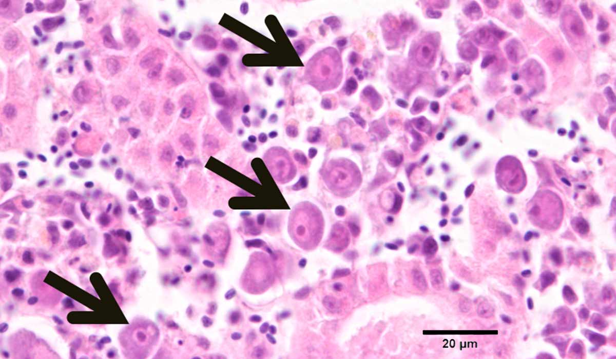 Imagem histológica do tecido renal de um Platy (Xiphophorus maculatus) infectado com ISKNV