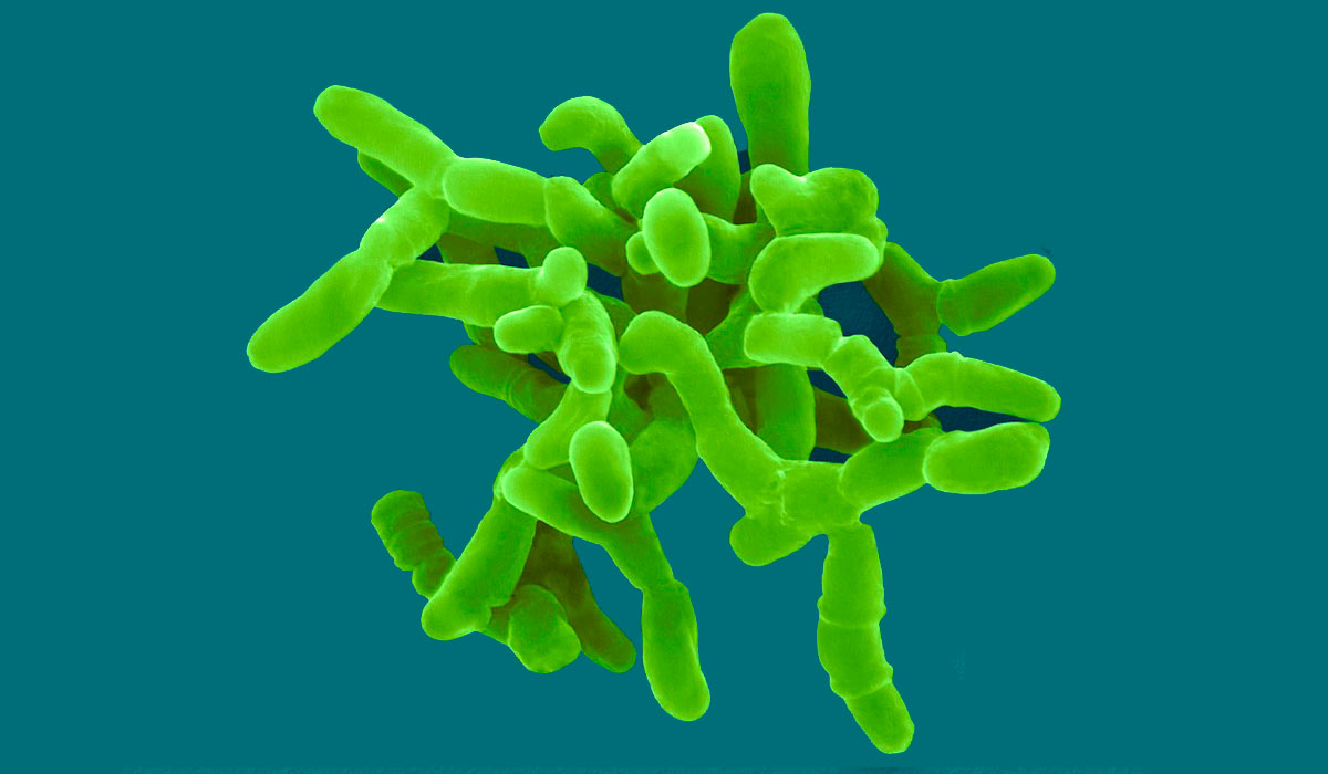 Mycobacterium avium subespécie paratuberculosis (MAP)